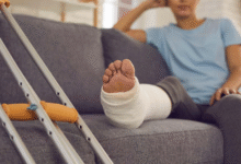 What to Do After an Accident: A Practical Guide to Protecting Your Recovery